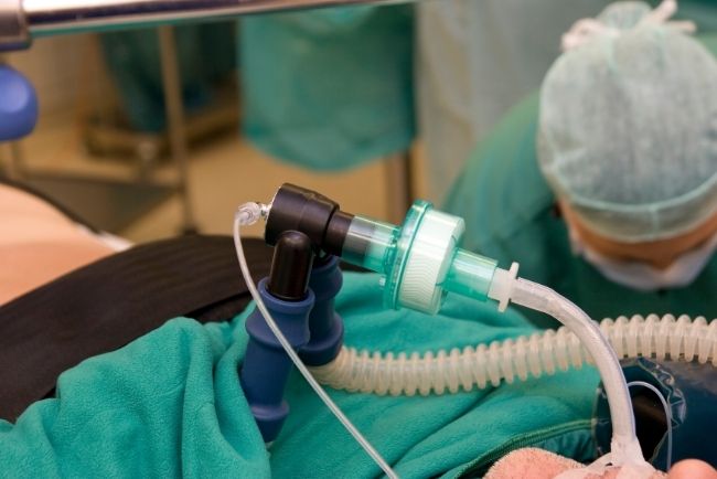 Entübe edilmiş hasta